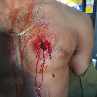 Casualty-Effects-bullet-wound-in-the-chest