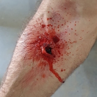 Casualty-Effects-forearm-bullet-wound